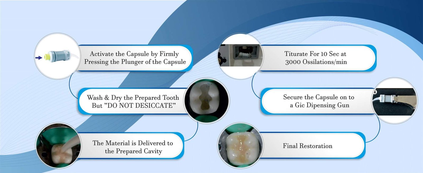 Glass ionomer cement capsule